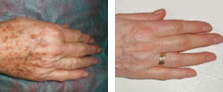 Photo Rejuvenation